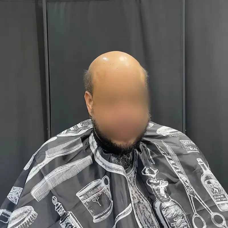 afro hair system before
