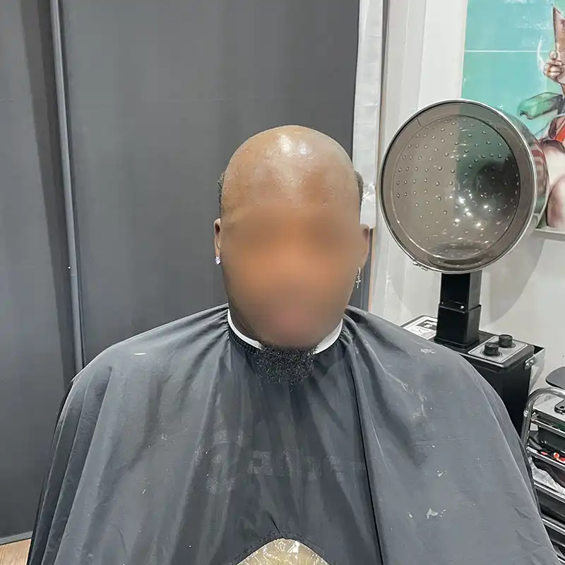 afro hair system before