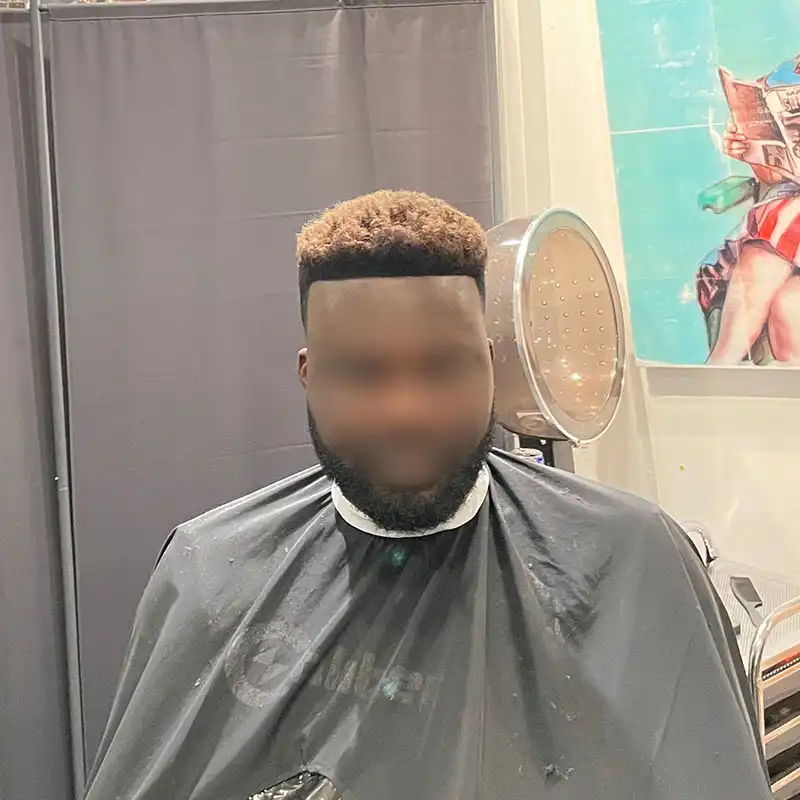 Afro 1 after front view