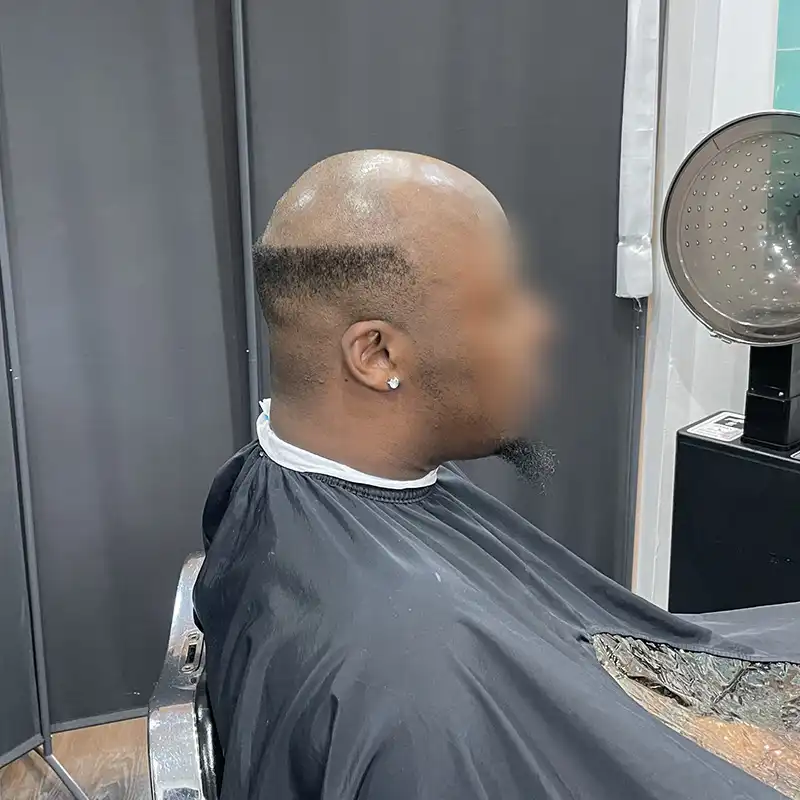 loc hair system before