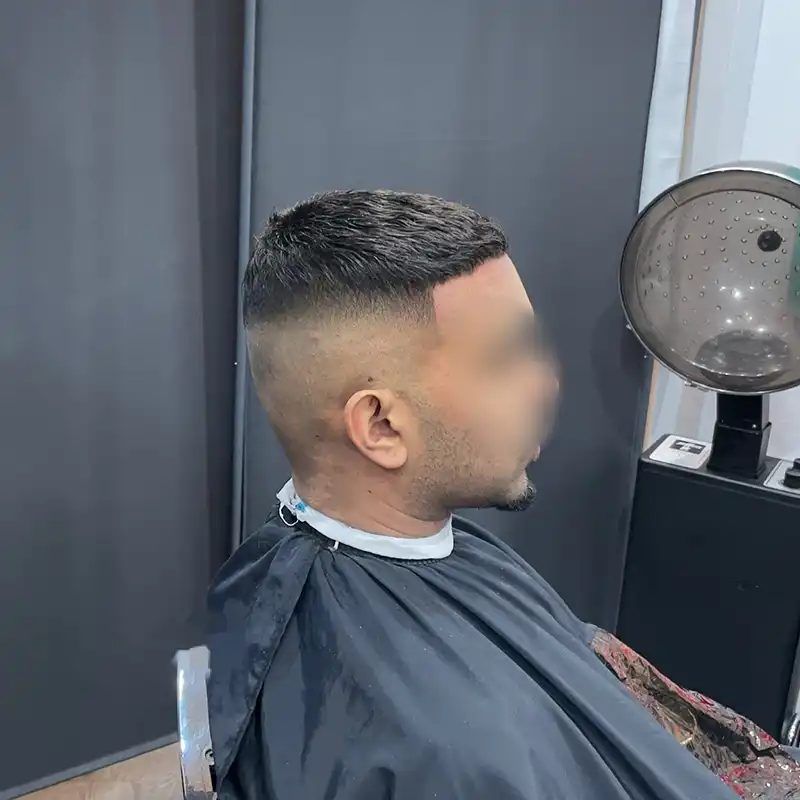 Straight 3 after front view