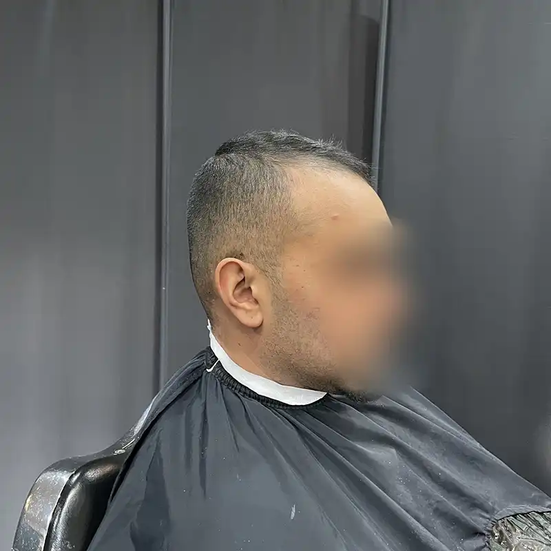 straight hair system before