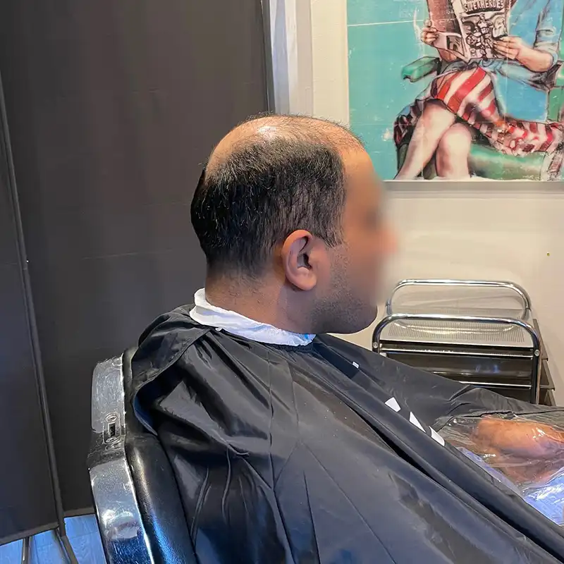 straight hair system before