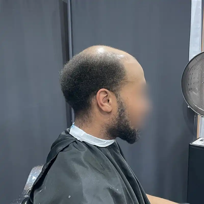 Wave 6 before view