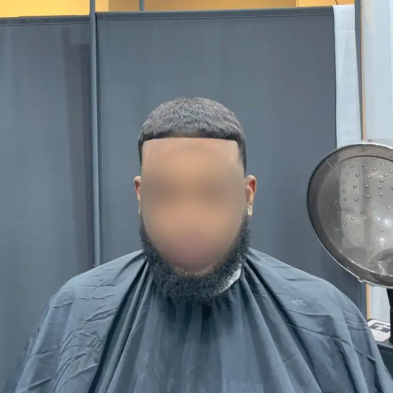Wave 5 after front view