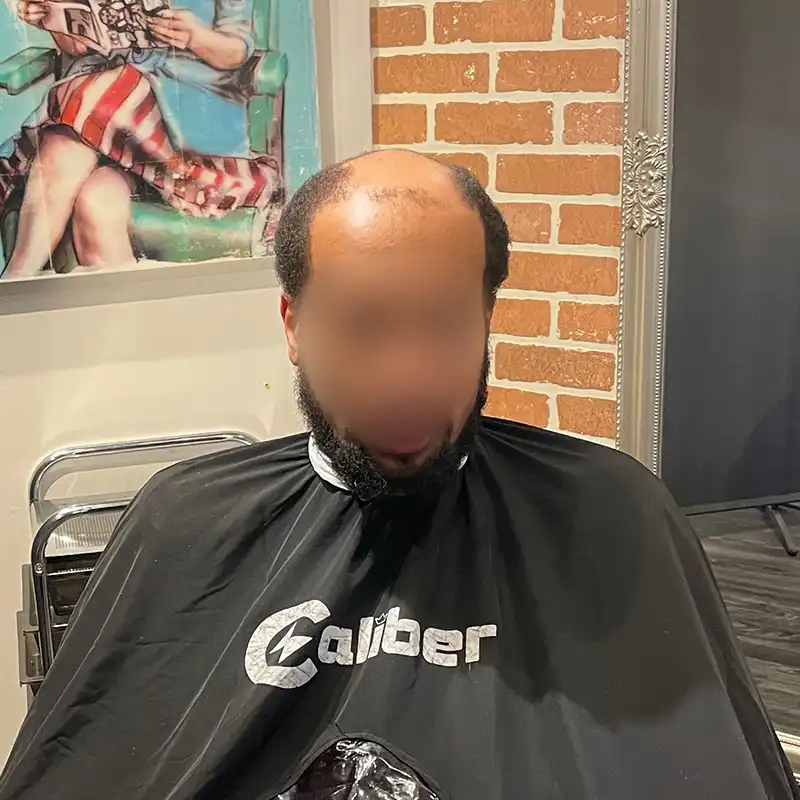 Wave 4 before view