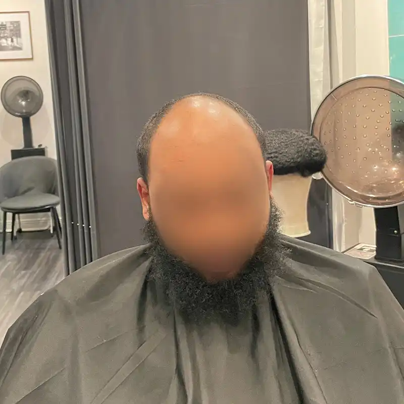Wave 3 before view