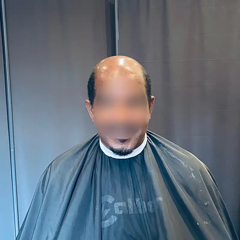 wave hair system before