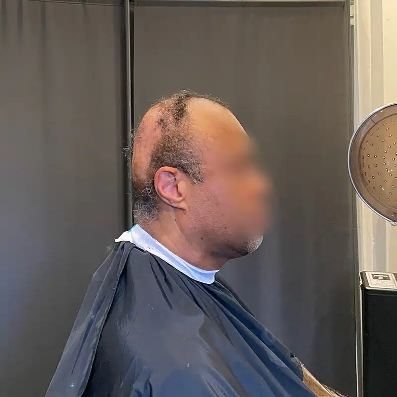 Wave 1 before view