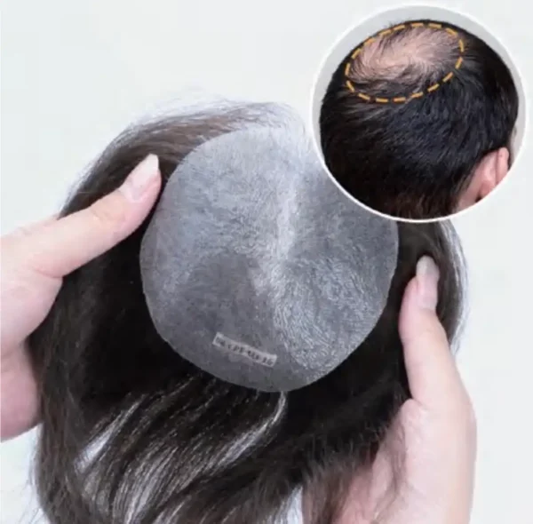 Super thin skins crown patch