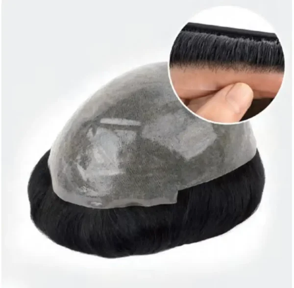 thin skin hair system closeup