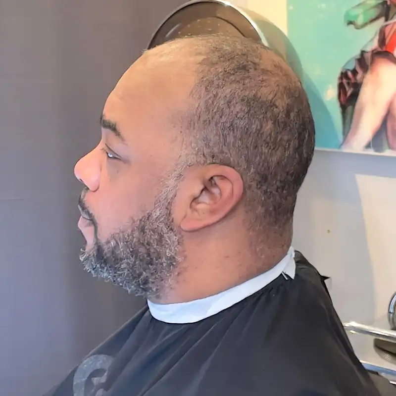 before hair system install